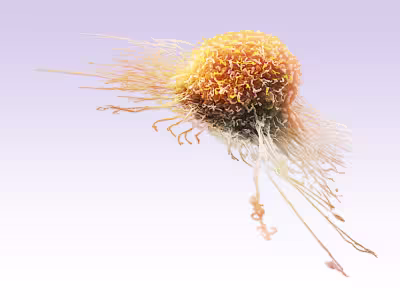 Cancer Cell Cancer Cell