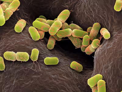E. coli Inflammation E. coli Inflammation