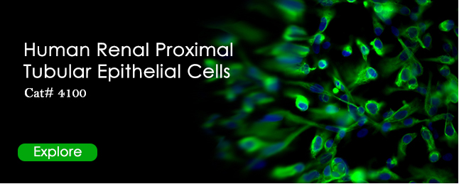 Human Renal Proximal Tubular Epithelial Cells (HRPTEpiC) – Caltag ...